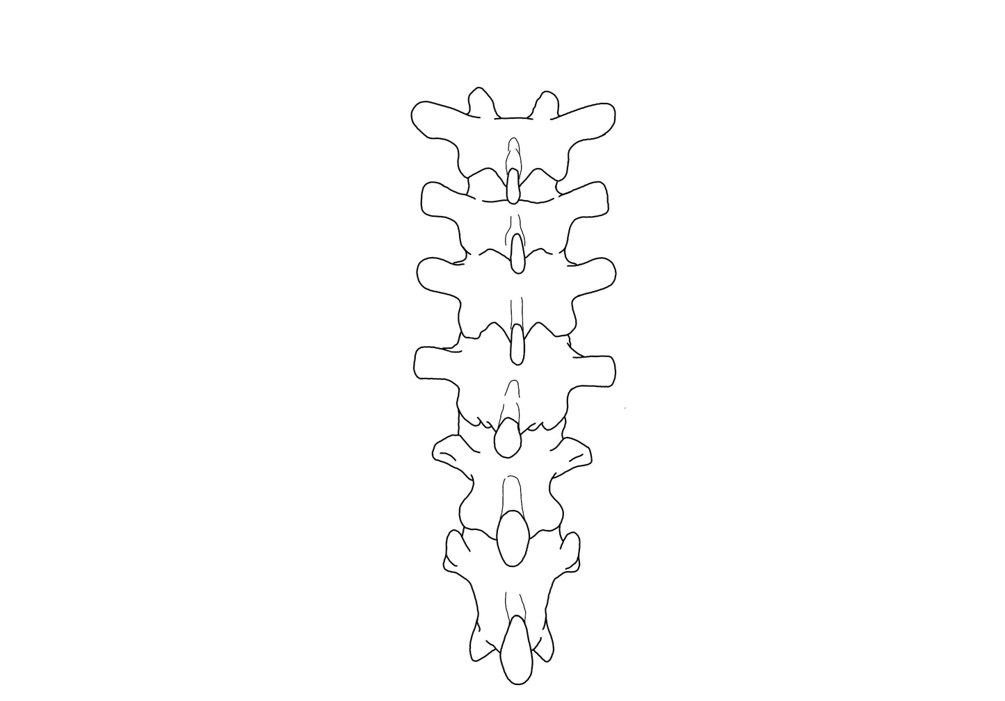 Spine T7-12 Custom