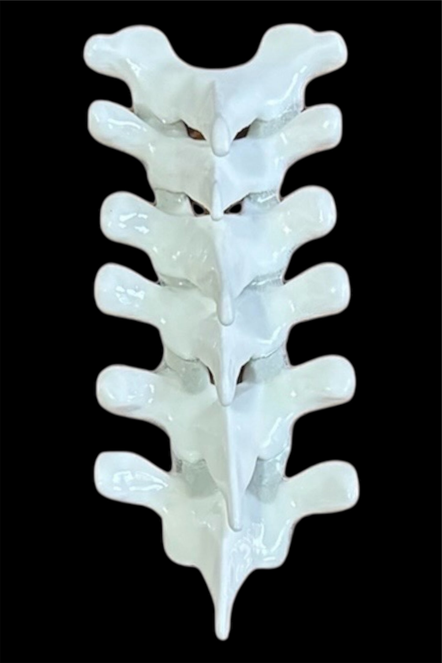 Spine Trio T1-6, T7-12, L1-5 Custom